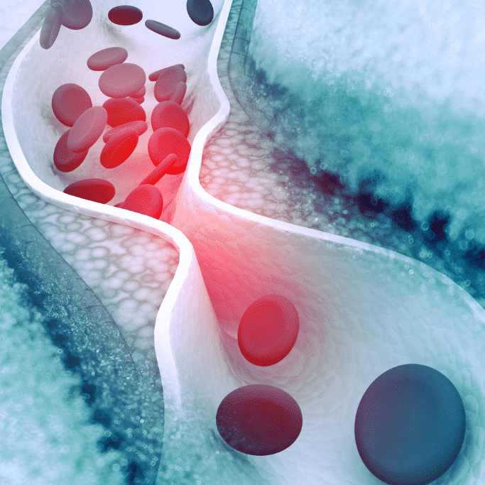 graphic of cholesterol